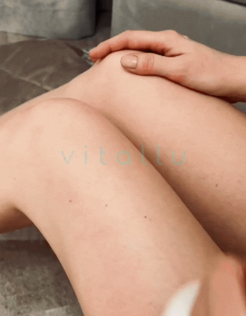 Massageador Anticelulite Portátil para Redução – CelluEase Pro 